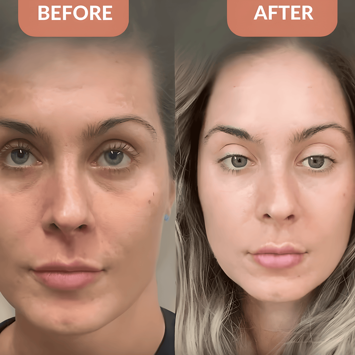 Astaxanthin Softgels